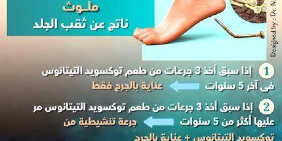 مرض التيتانوس «Tetanus».. الأعراض وطرق الوقاية - عرب فايف